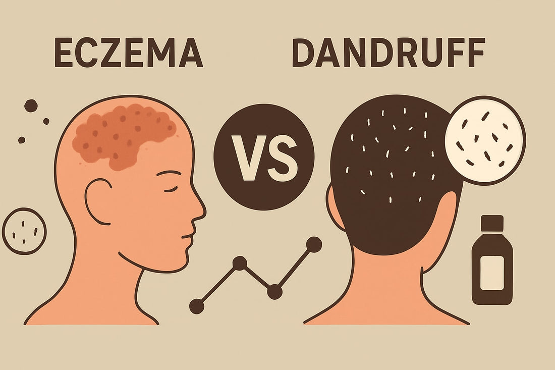Eczema Dandruff Versus: Key Differences & Relief in 2025
