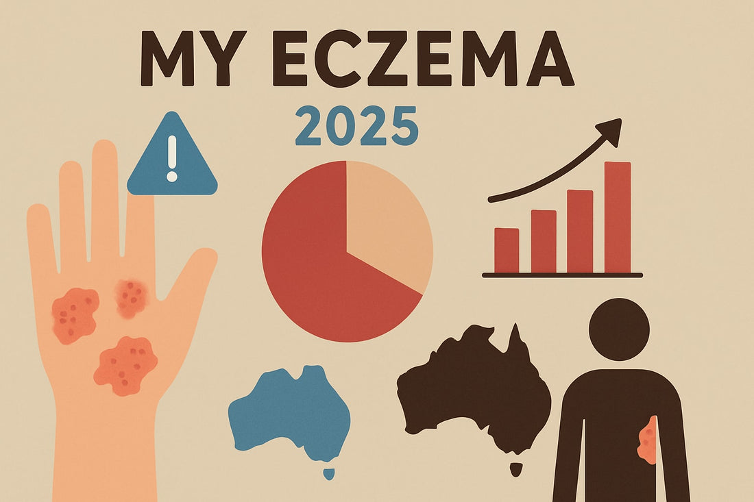 My Eczema Guide 2025: Understanding Triggers & Relief
